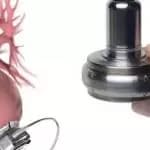 HeartWare Ventricular Assist Device Recalled